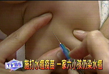 施打水痘疫苗　一家6小孩仍染水痘