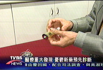 憂鬱診斷劑 核醫新發現