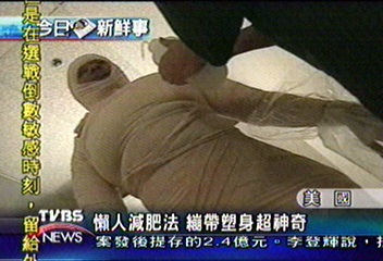 懶人減肥法　繃帶塑身超神奇