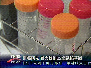 肝癌曙光　台大找到22個缺陷基因