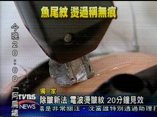 〈獨家〉除皺新法　電波燙皺紋　20分鐘見效