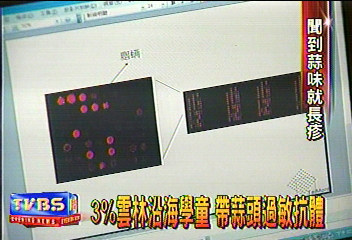 蒜頭引發小兒過敏 全球第2例