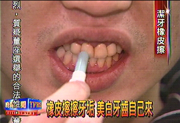 橡皮擦擦牙垢 美白牙齒自己來