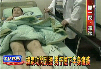 練氣功閃到腰　男子險下半身癱瘓