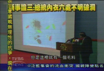 【神探李昌鈺關鍵報告】（三）總統傷口切片　有受到鉛磨擦