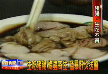 生吃豬腸 絛蟲寄生 猛暴肝炎送醫