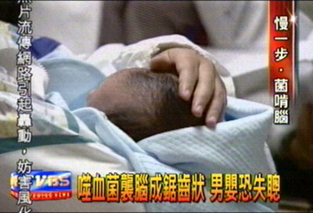 嗜血菌襲腦成鋸齒狀　男嬰恐失聰