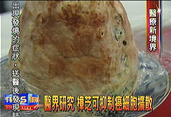 醫界研究 樟芝可抑制癌細胞擴散