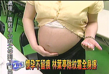 懷孕不留痕 林葉亭除紋霜全身擦