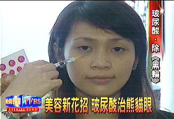 美容新花招 玻尿酸治熊貓眼