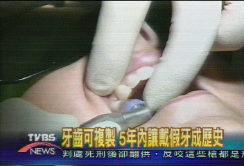 牙齒可複製 5年內讓戴假牙成歷史