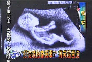 〈獨家〉打從娘胎會飆車？　搞笑超音波