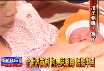 全世界首例 抱嬰兒側睡 媽媽中風