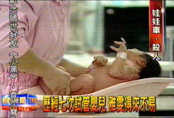 歷經7次試管嬰兒　雅雯得來不易