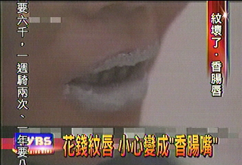 花錢紋唇　小心變成「香腸嘴」