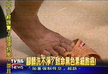 腳髒洗不淨? 致命黑色素細胞癌!
