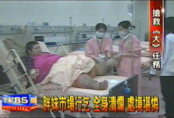 胖妹市場行乞　全身潰爛　處境堪憐