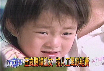 5歲聽障孤女 換人工耳缺經費