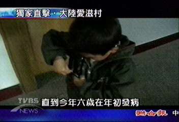 【大陸愛滋村】大陸資源貧乏 愛滋病患求醫困難