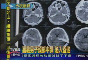 男子家中腦中彈 槍擊原因待釐清