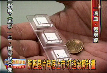 肝癌晶片年底上市 打造治療計畫