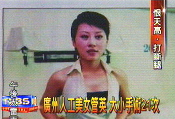大陸人工美女 為增高不怕苦