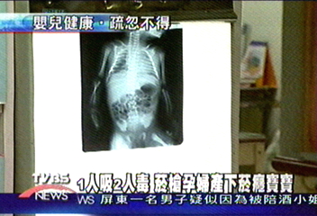 1人吸2人毒 煙槍孕婦產下煙癮寶寶