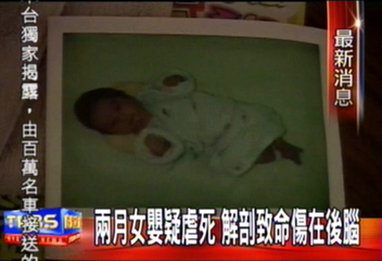 2個月女嬰疑虐死 解剖致命傷在後腦