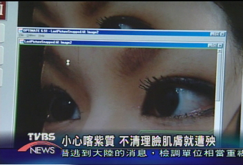 小心喀紫質 不清理臉肌膚就遭殃