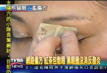網路偏方 紅茶包敷眼 黑眼圈沒消反發炎