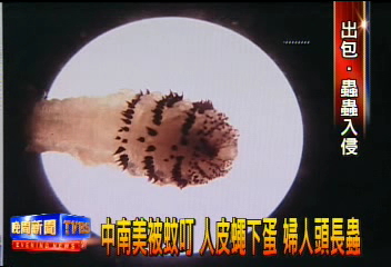 中南美被蚊叮　人皮蠅下蛋　婦人頭長蟲