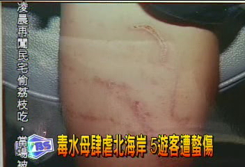 毒水母肆虐北海岸 5遊客遭螫傷