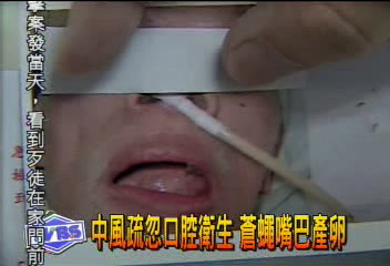 中風疏忽口腔衛生 蒼蠅嘴巴產卵