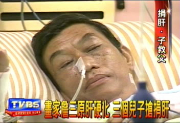 畫家詹三原肝硬化　3個兒子搶捐肝