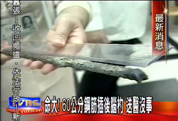 命大！　60公分鋼筋插後腦杓　送醫沒事