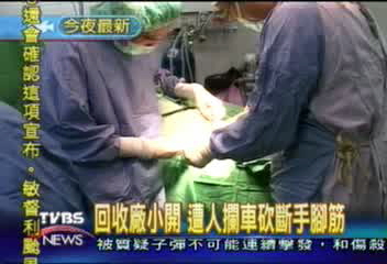 回收廠小開　遭人攔車砍斷手腳筋