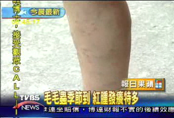 毛毛蟲的「毛」隨風飄揚 皮膚痛癢