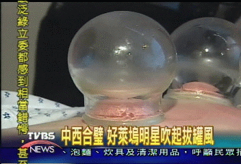 中西合璧 好萊塢明星吹起拔罐風