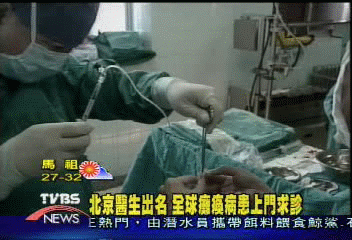 神經修復手術　北京醫生治癒癱瘓患者