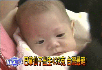 巴掌仙子出生432克 台灣最輕!