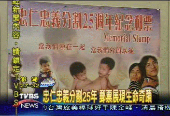 忠仁忠義分割25年 郵票展現生命奇蹟