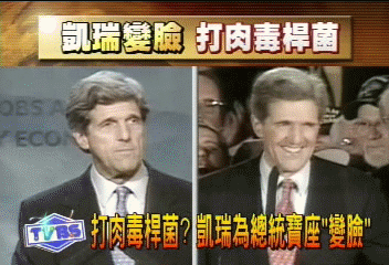 打肉毒桿菌? 凱瑞為總統寶座「變臉」