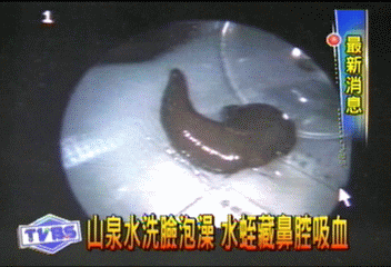 山泉水洗臉泡澡 水蛭藏鼻腔吸血