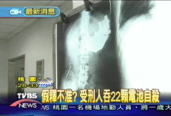 假釋不准?受刑人吞22顆電池自殺