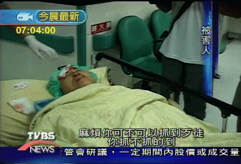 給了錢還砍人!婦人遭長刀大盜「砍掌」