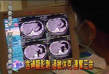 含碘顯影劑　過敏休克　連奪3命