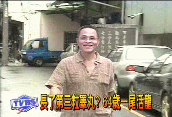 意外變「三粒」　老人「回春」白髮變黑