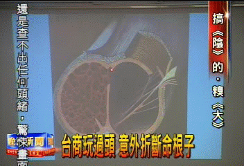 台商玩過頭 意外折斷命根子
