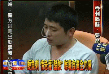 哽魚刺 灌「醋酸」 喉嚨食道全灼傷