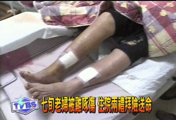 七旬老婦被雞啄傷 住院兩禮拜險送命